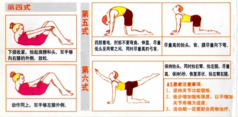 强直性脊柱炎最新疗法研究突破，创新疗法问世