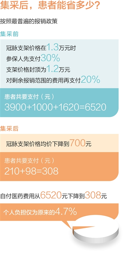 最新国产支架价格概览与小巷特色小店探秘
