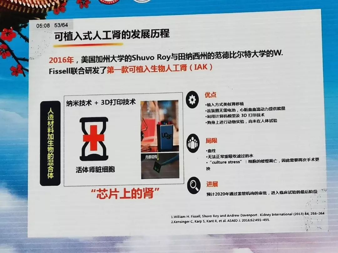 人工肾最新进展，最新消息综述
